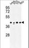 Calcium Activated Nucleotidase 1 antibody, LS-C168294, Lifespan Biosciences, Western Blot image 