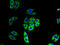NADH:Ubiquinone Oxidoreductase Subunit B11 antibody, A60006-100, Epigentek, Immunofluorescence image 