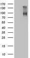 Coagulation Factor XIII B Chain antibody, TA805993S, Origene, Western Blot image 