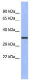 Wnt Family Member 4 antibody, TA329907, Origene, Western Blot image 
