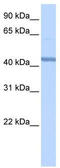 RNA Binding Motif Protein 22 antibody, TA343866, Origene, Western Blot image 