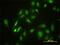 Serine/Threonine Kinase 4 antibody, H00006789-M01, Novus Biologicals, Immunofluorescence image 