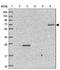 Zinc Finger Protein 623 antibody, NBP1-92637, Novus Biologicals, Western Blot image 