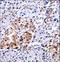 CUGBP Elav-Like Family Member 1 antibody, LS-C167156, Lifespan Biosciences, Immunohistochemistry paraffin image 