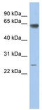 TATA-Box Binding Protein Associated Factor 5 Like antibody, TA330609, Origene, Western Blot image 