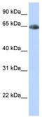 Solute Carrier Family 6 Member 2 antibody, TA346266, Origene, Western Blot image 