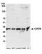 Capping Actin Protein Of Muscle Z-Line Subunit Beta antibody, A304-734A, Bethyl Labs, Western Blot image 
