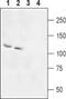 Electrogenic sodium bicarbonate cotransporter 4 antibody, PA5-77551, Invitrogen Antibodies, Western Blot image 