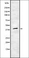 CD28 antibody, orb337531, Biorbyt, Western Blot image 