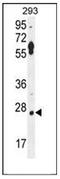 Leucine Rich Repeat Containing 57 antibody, AP52542PU-N, Origene, Western Blot image 