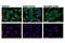Microtubule Associated Protein 1 Light Chain 3 Beta antibody, 14079S, Cell Signaling Technology, Immunofluorescence image 