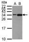 Histone Cluster 1 H1 Family Member C antibody, GTX122561, GeneTex, Western Blot image 