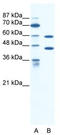 Cation Channel Sperm Associated 2 antibody, TA338748, Origene, Western Blot image 