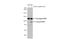 Neuraminidase antibody, GTX636805, GeneTex, Western Blot image 