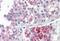 Sperm Associated Antigen 16 antibody, orb20446, Biorbyt, Immunohistochemistry paraffin image 
