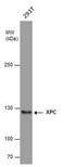 DNA repair protein complementing XP-C cells antibody, MA1-23328, Invitrogen Antibodies, Western Blot image 