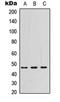 Pregnancy Specific Beta-1-Glycoprotein 3 antibody, orb234946, Biorbyt, Western Blot image 