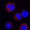 LYN Proto-Oncogene, Src Family Tyrosine Kinase antibody, MAB3206, R&D Systems, Immunofluorescence image 