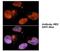 Ubiquitin Conjugating Enzyme E2 N antibody, NBP1-55027, Novus Biologicals, Immunofluorescence image 