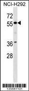 Zinc Finger Protein 512 antibody, 58-448, ProSci, Western Blot image 