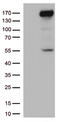 Xanthine Dehydrogenase antibody, TA812777, Origene, Western Blot image 