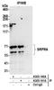 SRP Receptor Subunit Alpha antibody, A305-140A, Bethyl Labs, Immunoprecipitation image 