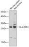 Major Histocompatibility Complex, Class II, DP Beta 1 antibody, 15-312, ProSci, Western Blot image 