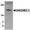 Vitamin K epoxide reductase complex subunit 1 antibody, PA5-34358, Invitrogen Antibodies, Western Blot image 