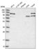 DExD/H-Box Helicase 58 antibody, NBP2-55599, Novus Biologicals, Western Blot image 