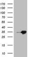 Mediator Complex Subunit 30 antibody, NBP2-45781, Novus Biologicals, Western Blot image 
