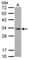 Inhibitor of growth protein 5 antibody, TA308527, Origene, Western Blot image 
