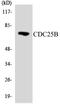 Cell Division Cycle 25B antibody, LS-C291780, Lifespan Biosciences, Western Blot image 