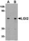 Leucine Rich Repeat LGI Family Member 2 antibody, TA306537, Origene, Western Blot image 