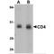 CD4 antibody, TA349005, Origene, Western Blot image 
