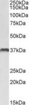 CLEC12A antibody, MBS423406, MyBioSource, Western Blot image 