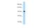 Rho guanine nucleotide exchange factor 26 antibody, A09528, Boster Biological Technology, Western Blot image 