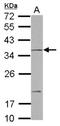 Notch 2 N-Terminal Like A antibody, NBP2-19595, Novus Biologicals, Western Blot image 
