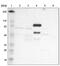 Coagulation Factor XIII B Chain antibody, PA5-52004, Invitrogen Antibodies, Western Blot image 