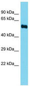 Fatty Acid Desaturase 3 antibody, TA338473, Origene, Western Blot image 