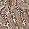 Cell Cycle Progression 1 antibody, NBP1-87954, Novus Biologicals, Immunohistochemistry frozen image 