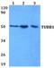 Tubulin Beta 1 Class VI antibody, A05397, Boster Biological Technology, Western Blot image 