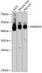 Melanoma-associated antigen 4 antibody, GTX64668, GeneTex, Western Blot image 