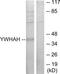 Tyrosine 3-Monooxygenase/Tryptophan 5-Monooxygenase Activation Protein Eta antibody, TA314676, Origene, Western Blot image 