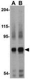 Nicastrin antibody, GTX31752, GeneTex, Western Blot image 