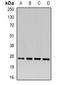 Carcinoembryonic antigen-related cell adhesion molecule 3 antibody, orb377989, Biorbyt, Western Blot image 