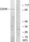 Cadherin 8 antibody, LS-C119420, Lifespan Biosciences, Western Blot image 