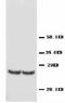 TIMP Metallopeptidase Inhibitor 4 antibody, LS-C171710, Lifespan Biosciences, Western Blot image 