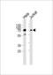 Serine/threonine-protein kinase PAK 3 antibody, LS-C164516, Lifespan Biosciences, Western Blot image 