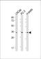 Ring Finger Protein 4 antibody, M02875, Boster Biological Technology, Western Blot image 