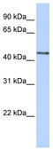 UDP-GlcNAc:BetaGal Beta-1,3-N-Acetylglucosaminyltransferase 4 antibody, TA346843, Origene, Western Blot image 